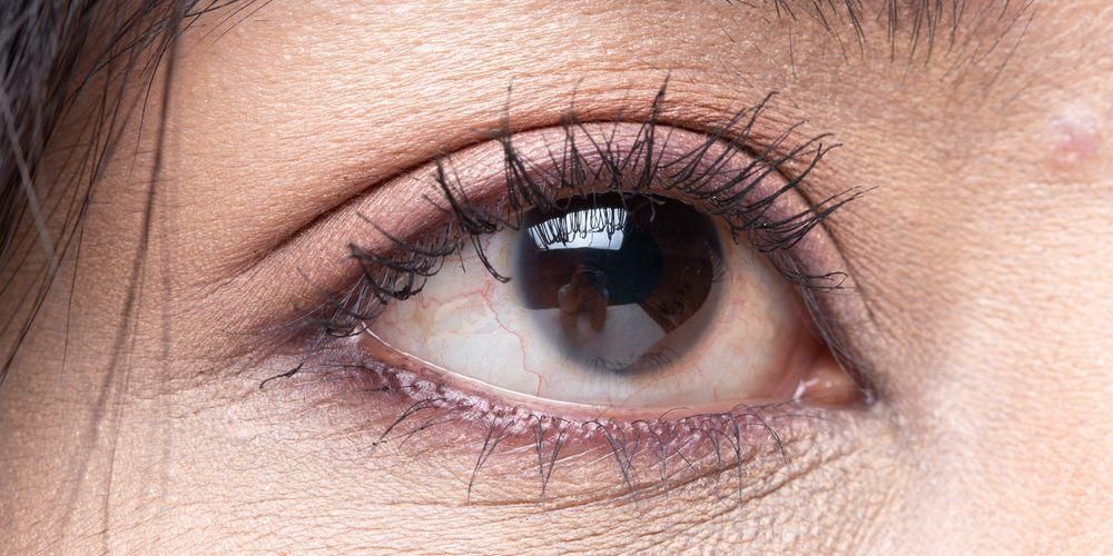 الكشف عن معنى نشل العين اليمنى السفلية من النظارات الطبية