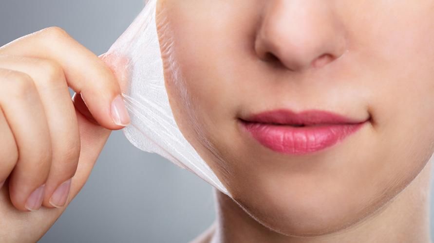 あなたが経験する顔の皮膚の剥離の6つの原因、あなたは何ですか？