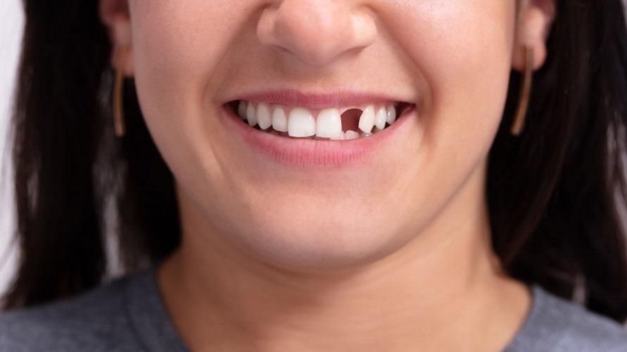 C'è un modo per far ricrescere i denti anche quando cadono da adulti?