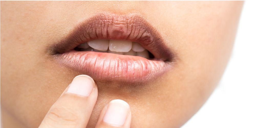 7 причини за сърбящи устни и как да го преодолеем
