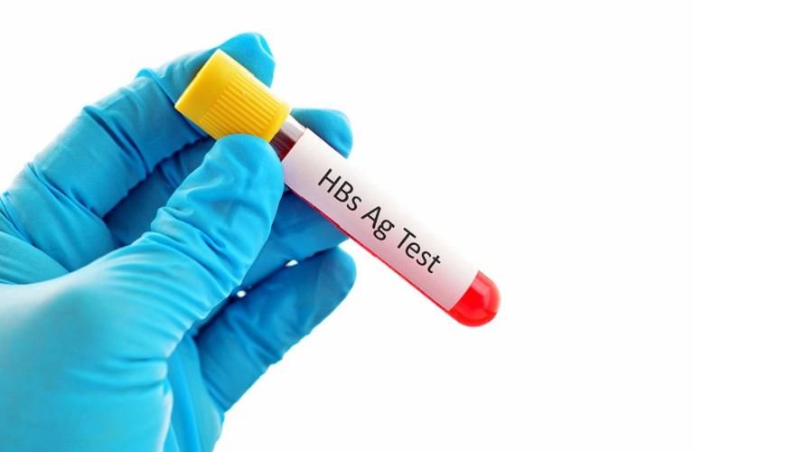 HBsAg เป็นบวกหรือเกิดปฏิกิริยาระหว่างการทดสอบในห้องปฏิบัติการ ซึ่งหมายความว่า