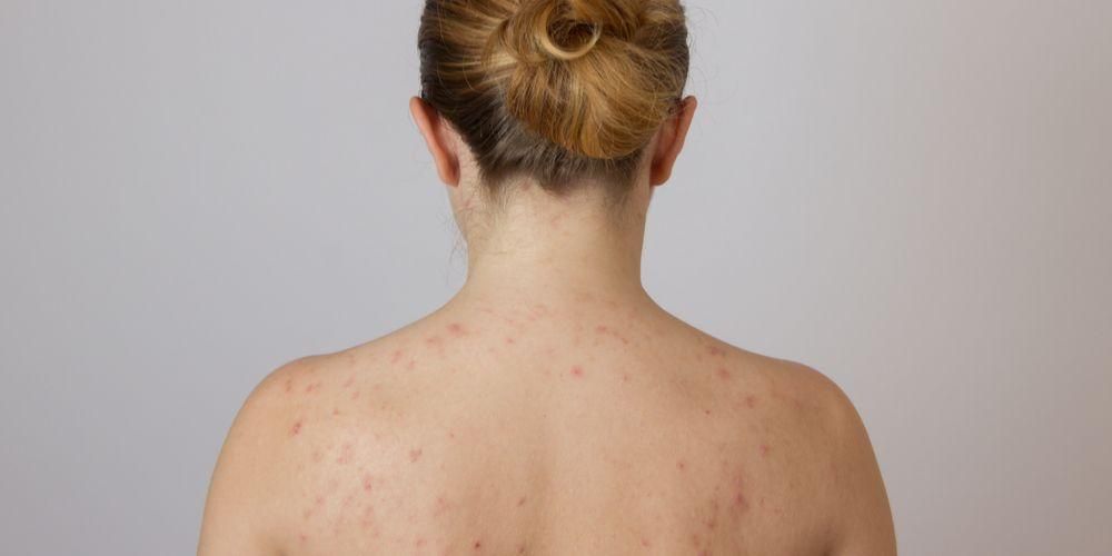 Причини за червени петна по сърбяща кожа