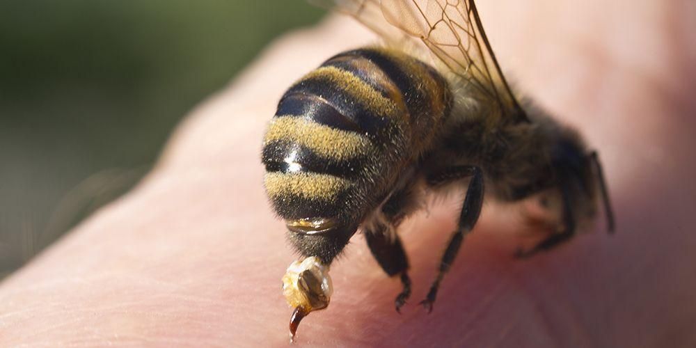 علاج لسعات النحل بالمكونات الطبيعية في المنزل