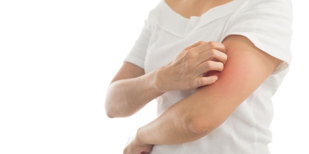 4 أنواع من العدوى الفطرية للجلد سعفة الجلد والتي تسبب الحكة وعدم الراحة