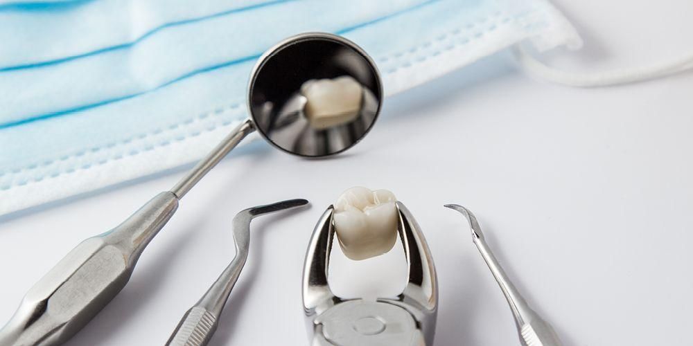 Mengenal Proses Pengambilan Gigi dari awal hingga akhir