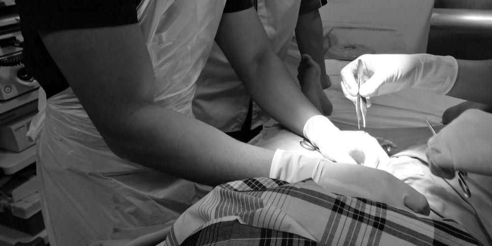 Conosci i vari tipi di circoncisione moderna che sono sempre più popolari