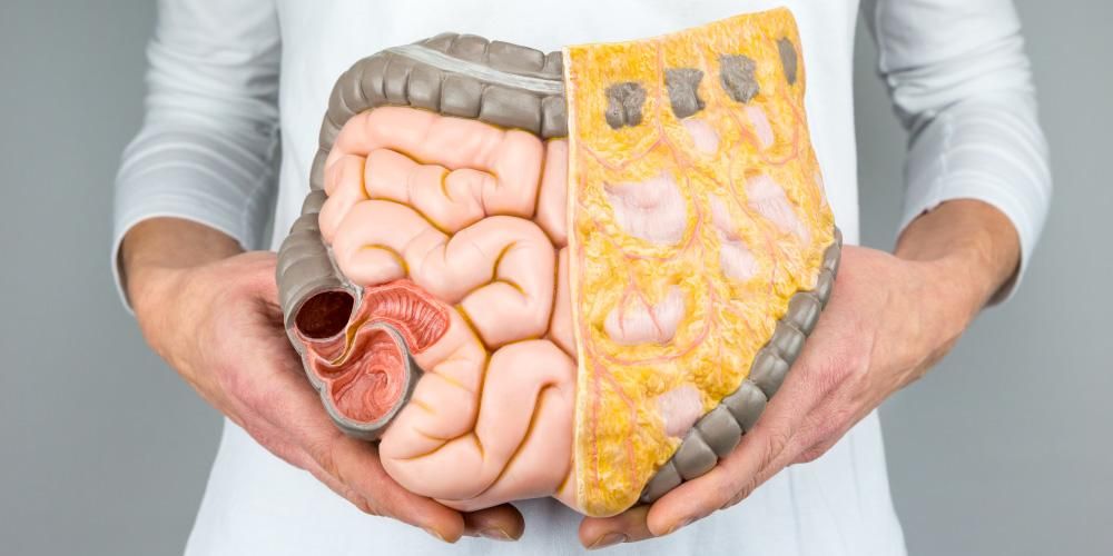 Esame del rumore intestinale normale per la rilevazione del blocco intestinale, chi ne ha bisogno?