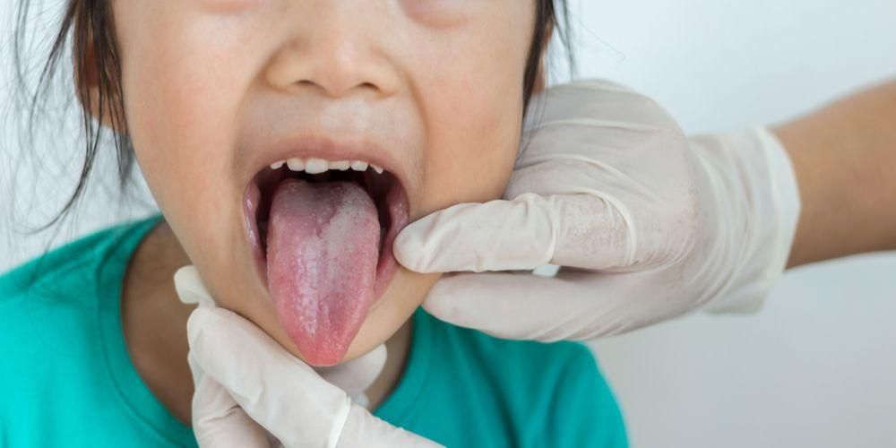 8 причини за подутини по езика, за които трябва да внимавате