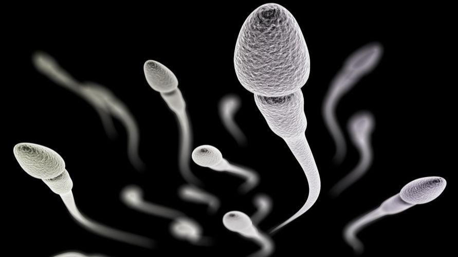 La teratozoospermia può influenzare la fertilità maschile, riconoscere le cause e come trattarla