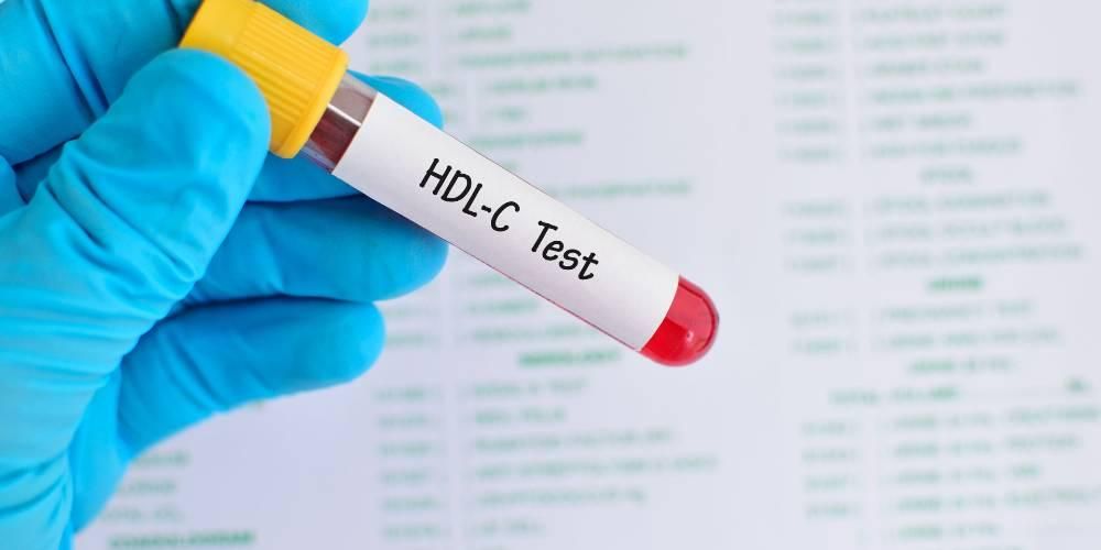 HDL добрият холестерол, как да го повишим?