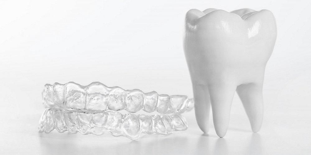 Предимства и недостатъци на прозрачните брекети за изправяне на зъбите