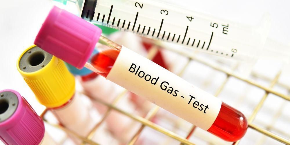تعرف على تحليل غازات الدم ، الفحص التفصيلي لصحة الأعضاء الحيوية
