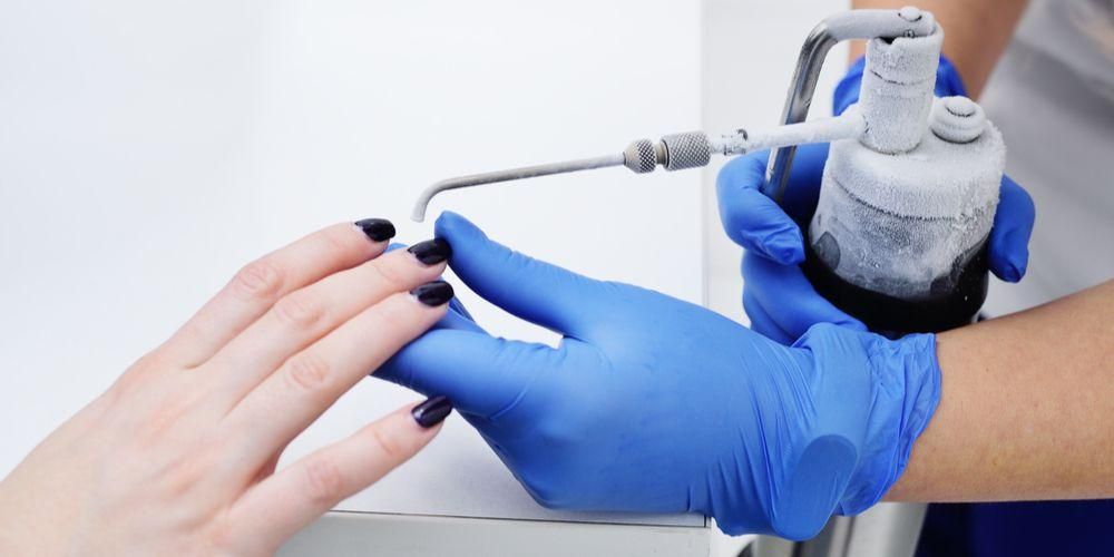 Bagaimana cara menghilangkan ketuat dengan ubat gigi, adakah ia berkesan?