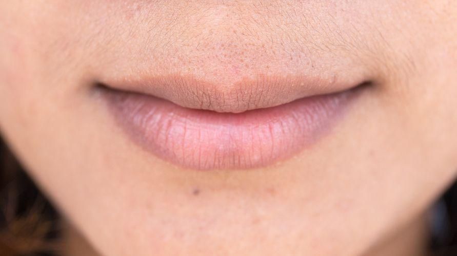 Conoscere le lentiggini sulle labbra (macchie di Fordyce) che possono disturbare l'aspetto