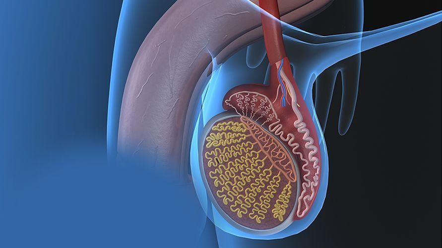 รู้สาเหตุของ Varicoceles และวิธีการรักษา