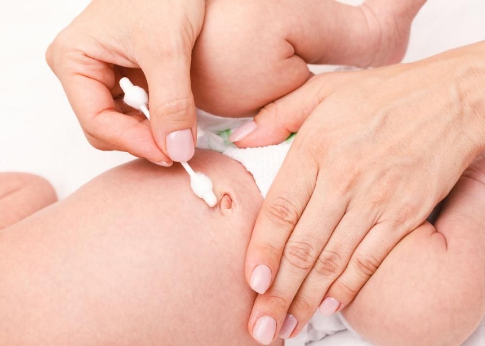 L'ombelico del bambino puzzolente e acquoso può essere un segno di infezione, riconoscere i sintomi