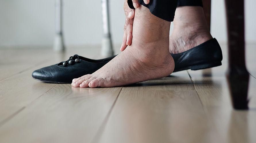 Comprendere le cause dei piedi gonfi negli anziani e come superarlo