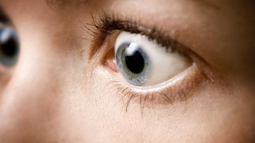 Şişkin ve çıkıntılı gözler hipertiroidizmden kaynaklanabilir.
