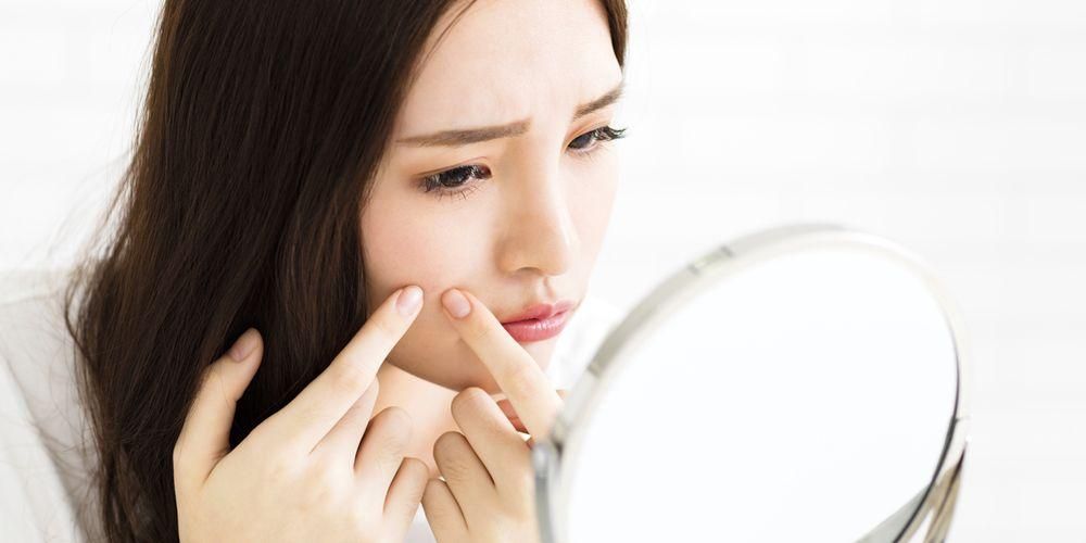 Le cause dell'acne sono varie, riconosci i fattori di rischio e le abitudini che la scatenano