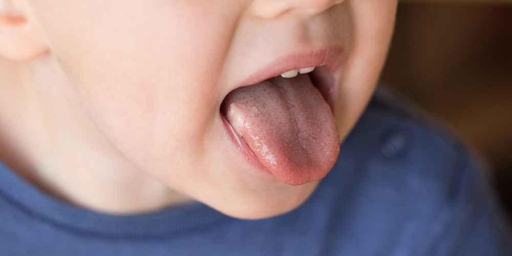 ツグミに似た舌がんの症状、違いは何ですか？