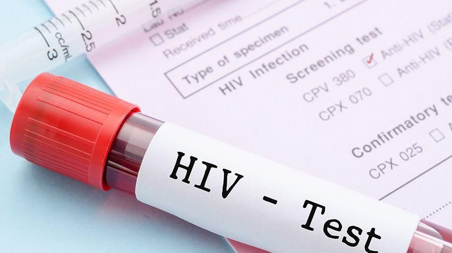 Punca HIV AIDS dan Pelbagai Faktor Risiko