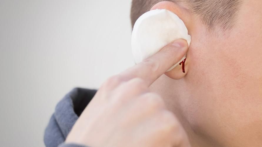 Gendang telinga pecah: Punca, Cara Mengubati, hingga Pencegahan