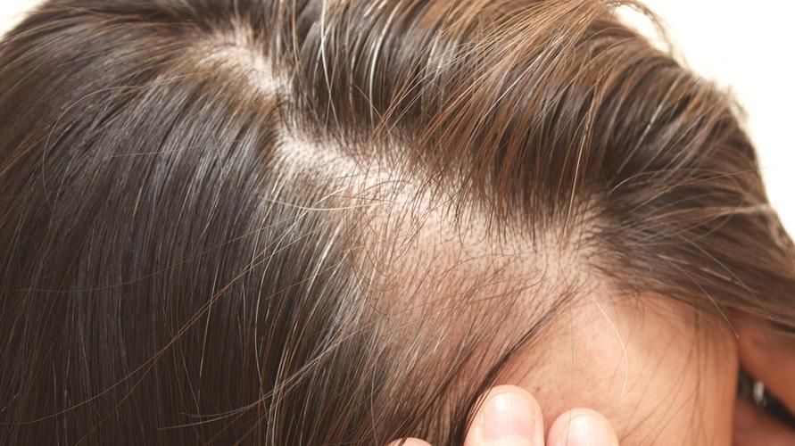 細い髪の原因とそれに対処する正しい方法