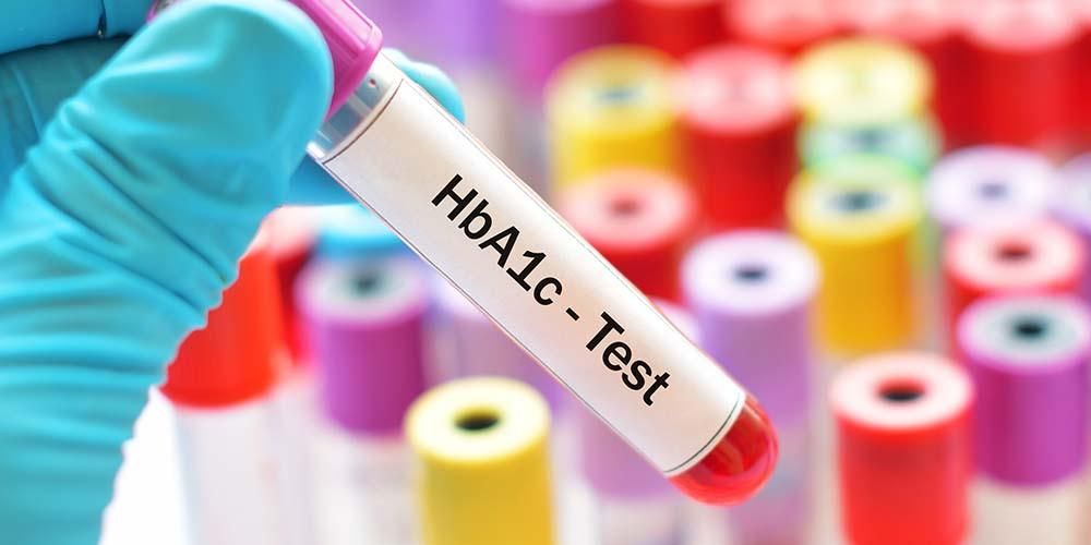 Normal HbA1C Seviyesi Nedir?
