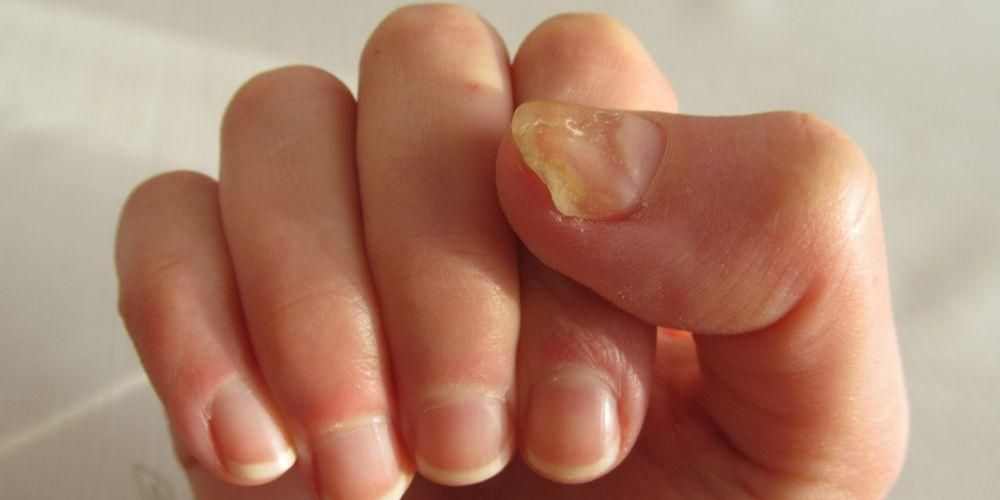 Запознайте се с различните причини за жълти нокти, които може да изпитате