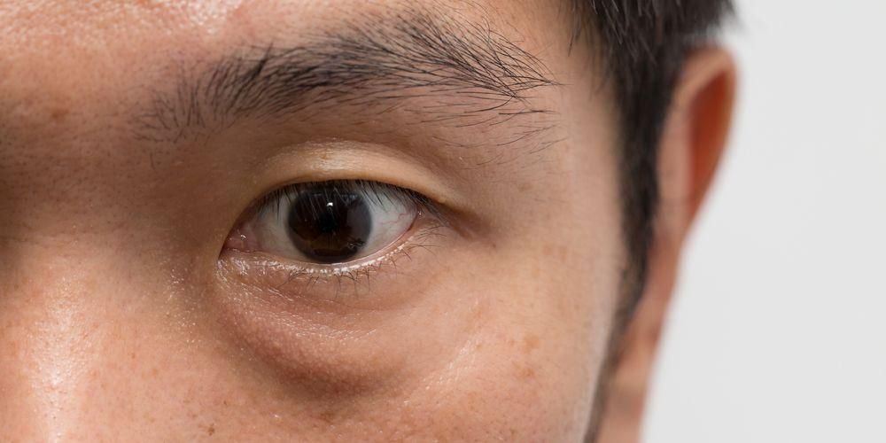 Значението на долното ляво око се потрепва от здравната страна