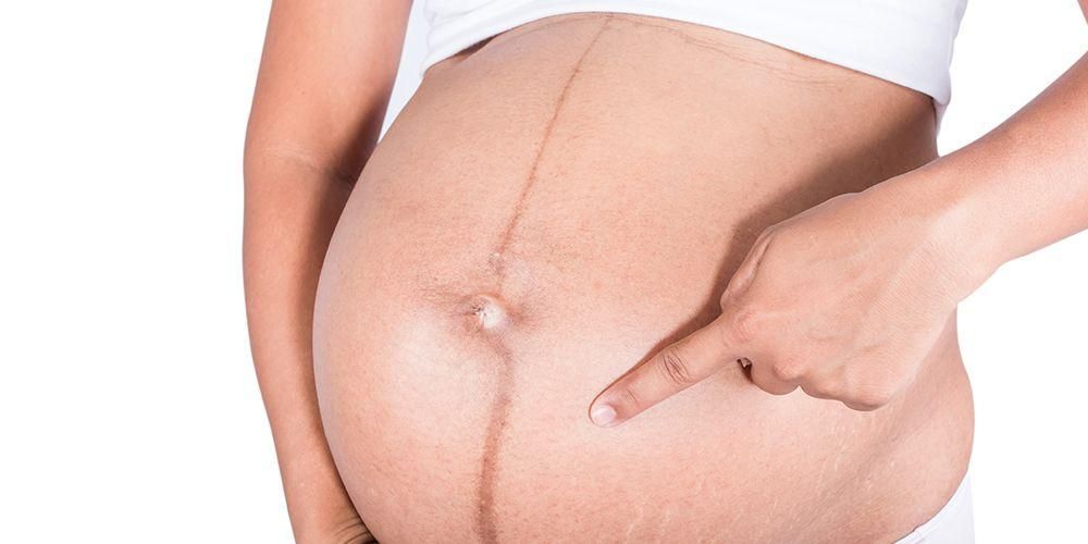 التعرف على الخطوط السوداء أو الخطوط الداكنة على المعدة أثناء الحمل