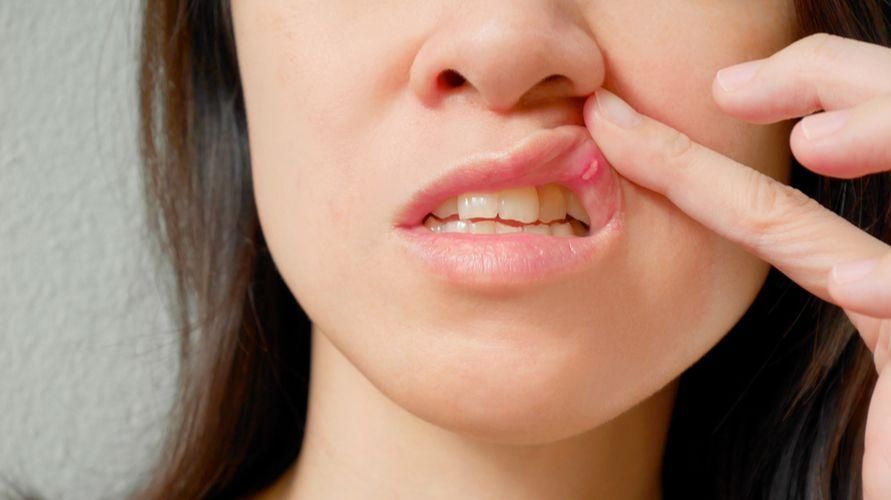 Dikkat Etmeniz Gereken Ağız ve Diş Hastalıkları Türleri