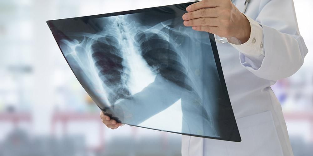Islak akciğerlerin özellikleri ve buna neden olan bir dizi hastalık